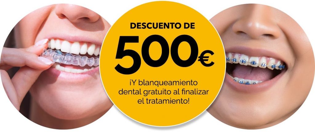 promocion-ortodoncia-en-caceres